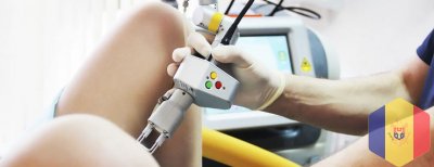 Condiloame genitale: îndepărtarea laser a verucilor genitali si condiloamelor in Moldova ( Chisinau