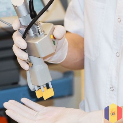 Лазерное удаление кондилом и генитальных бородавок в Кишиневе, Молдове!