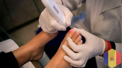 Corectie laser (Tratament laser) a unghiei incarnate