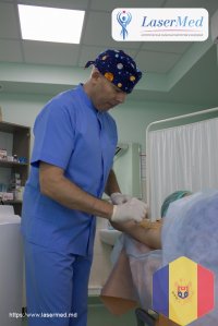 Tratamentul cu laser a hiperhodrozei axilare in Moldova!