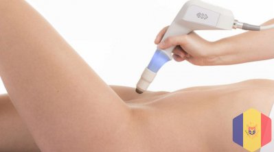 Reintinerirea vaginului cu laser sau rejuvenare vaginala (vaginoplastie cu laser) in Moldova!