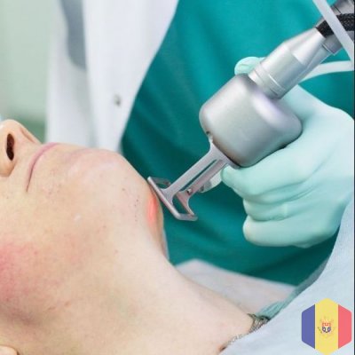 Лазерное удаление шрамов и рубцов (Лазерная коррекция дефектов кожи (рубцов/шрамов)) в Кишиневе, Мол