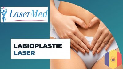 Chirurgie estetica intima: Laser plastia labiilor minore (labioplastia cu laser) in Chisinau, Moldov