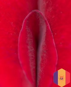 Интимное омоложение: Лазерное омоложение влагалища, Лазерный лифтинг влагалища (лазерная вагинопласт