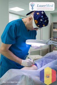 Лазерное удаление купероза и сосудистых звездочек на ногах в кабинете лазерной хирургии “LaserMedMol