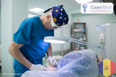 Лазерное удаление купероза и сосудистых звездочек на ногах в кабинете лазерной хирургии “LaserMedMol